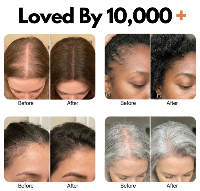 Velony RootRenew™ PDRN Scalp Brush Serum