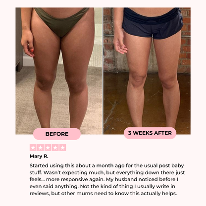 Velony Dual Support Activation