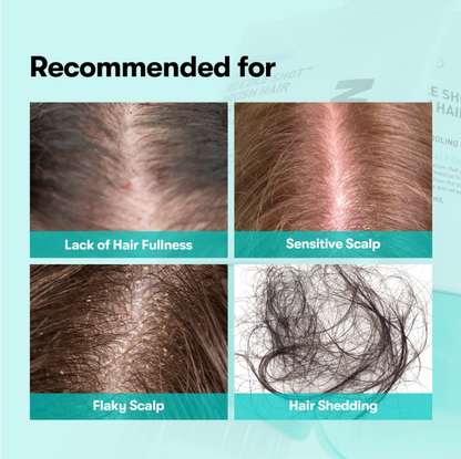 Velony RootRenew™ PDRN Scalp Brush Serum
