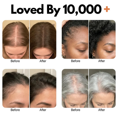 Velony RootRenew™ PDRN Scalp Brush Serum