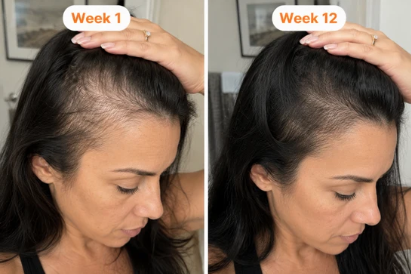 Velony RootRenew™ PDRN Scalp Brush Serum