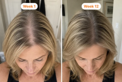 Velony RootRenew™ PDRN Scalp Brush Serum