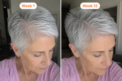 Velony RootRenew™ PDRN Scalp Brush Serum