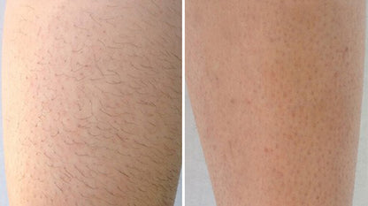 Velony Hair Removal Mousse