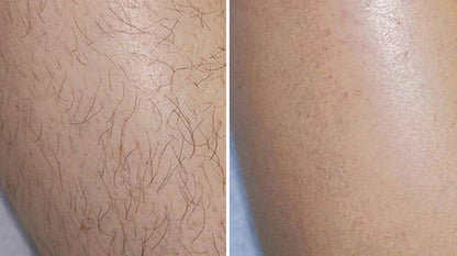 Velony Hair Removal Mousse